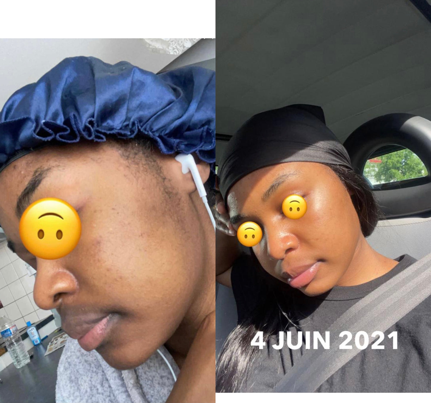 CRÈME VISAGE ANTI-HYPERPIGMENTATION