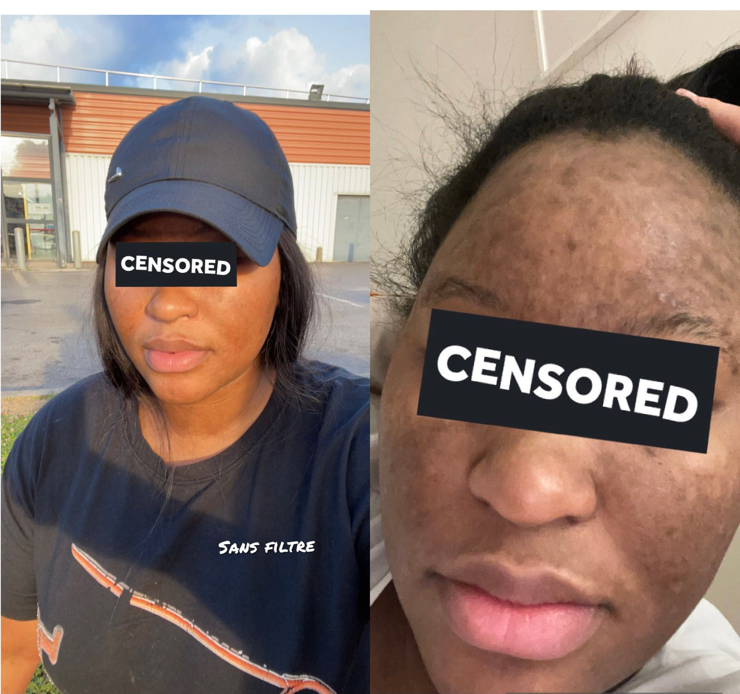 KIT VISAGE ANTI-HYPERPIGMENTATION